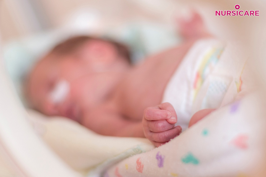 Nascer antes do tempo – nascimento prematuro