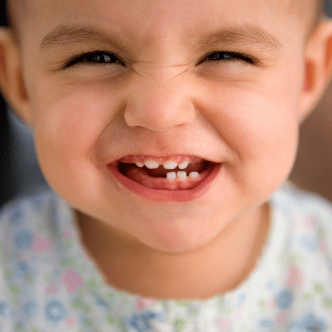 Ребенок без молочных зубов. Красивые детские зубы. Маленькие зубы у ребенка.